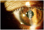 Corneal Dystrophy
