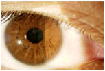 Eye Surgeon Union City