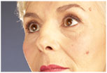 Cosmetic Surgery Union City