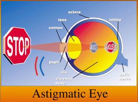 Eye Anotomy Astigmatic Eye