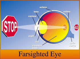 Eye Anotomy Farsighted Eye