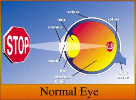 Eye Anotomy- Normal Eye