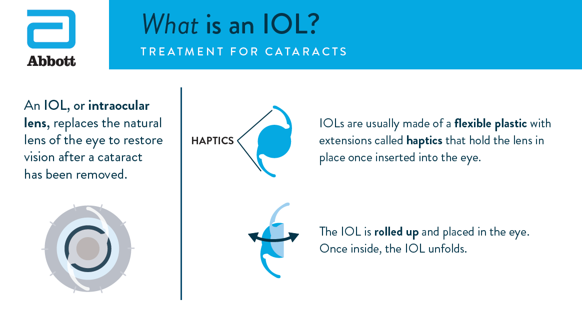 What is an intraocular lens (IOL)?