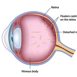 Parts of an eye