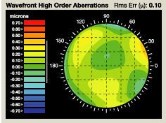 3D WaveFront map of eye for custom LASIK