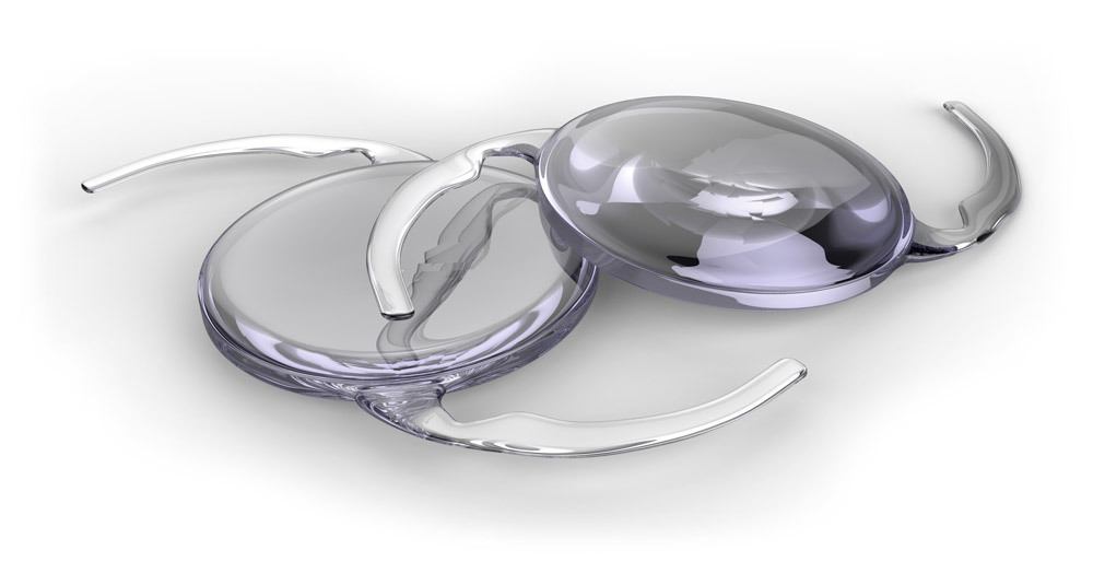 The Best Intraocular Lens for Cataract Surgery in Union City