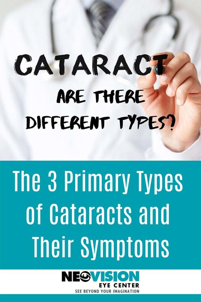 are there different types of cataracts?