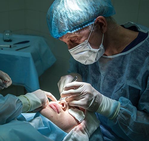 ophthalmologist performing treatment surgery for pterygium.