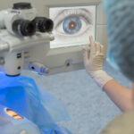 gloved hand hovering over Lasik display filled with image of patient's eye