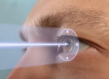 Man's upper face in profile with laser beam going to eye