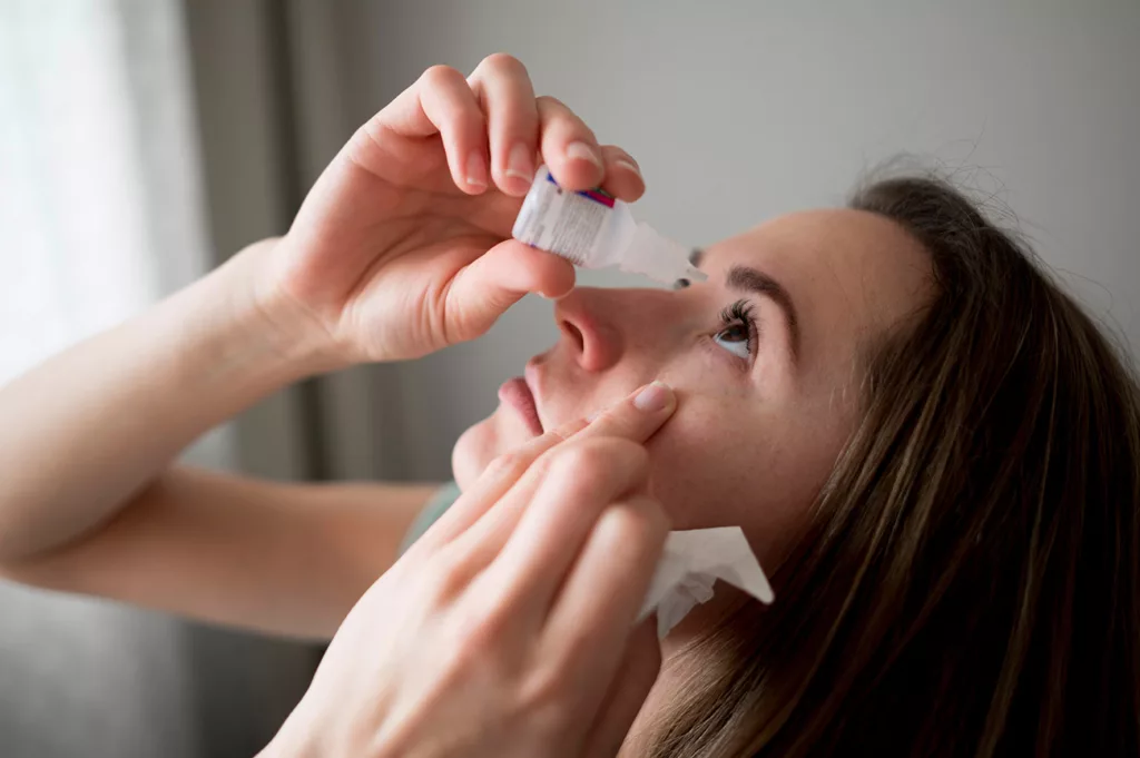 Woman tilting head back and squeezing eye drops into eye. 