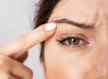 A woman with hazel eyes points a finger to her droopy eyelids