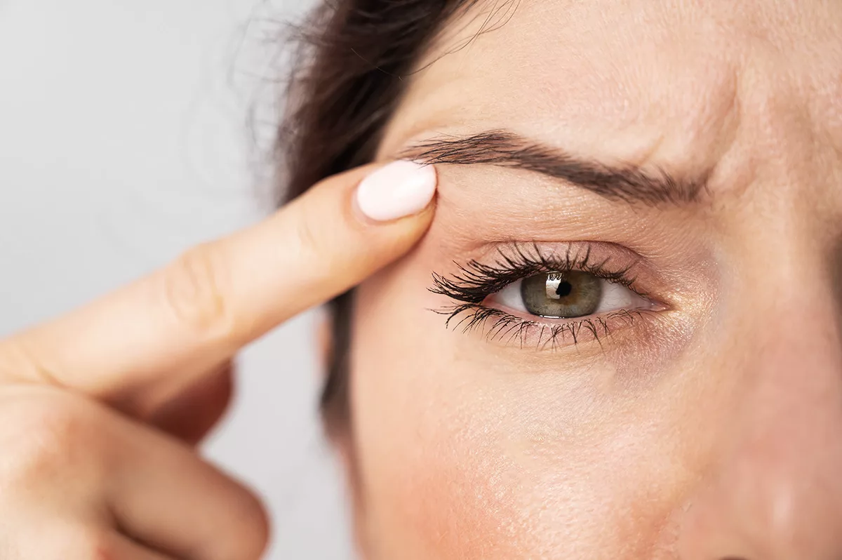 A woman with hazel eyes points a finger to her droopy eyelids